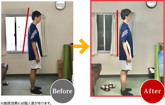 Before After